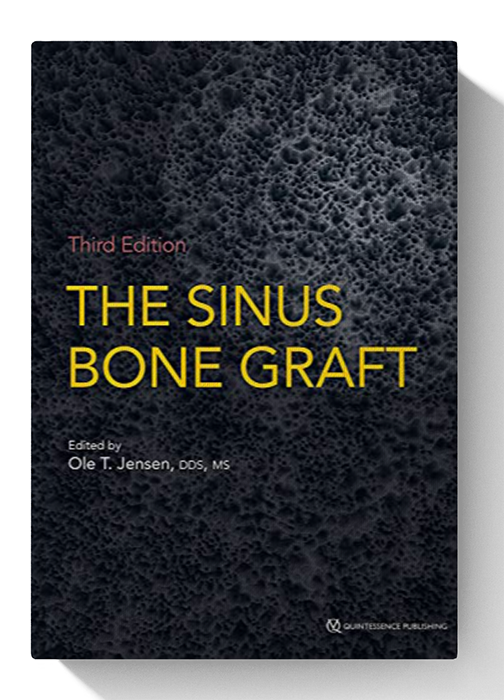 The Sinus Bone Graft, 3rd Edition 3rd Edition