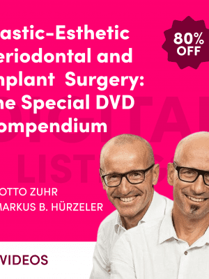 Plastic-Esthetic Periodontal and Implant Surgery: The Special DVD Compendium