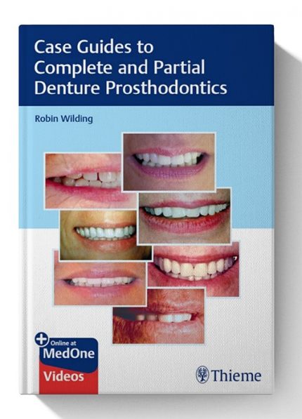 Case Guides to Complete and Partial Denture Prosthodontics